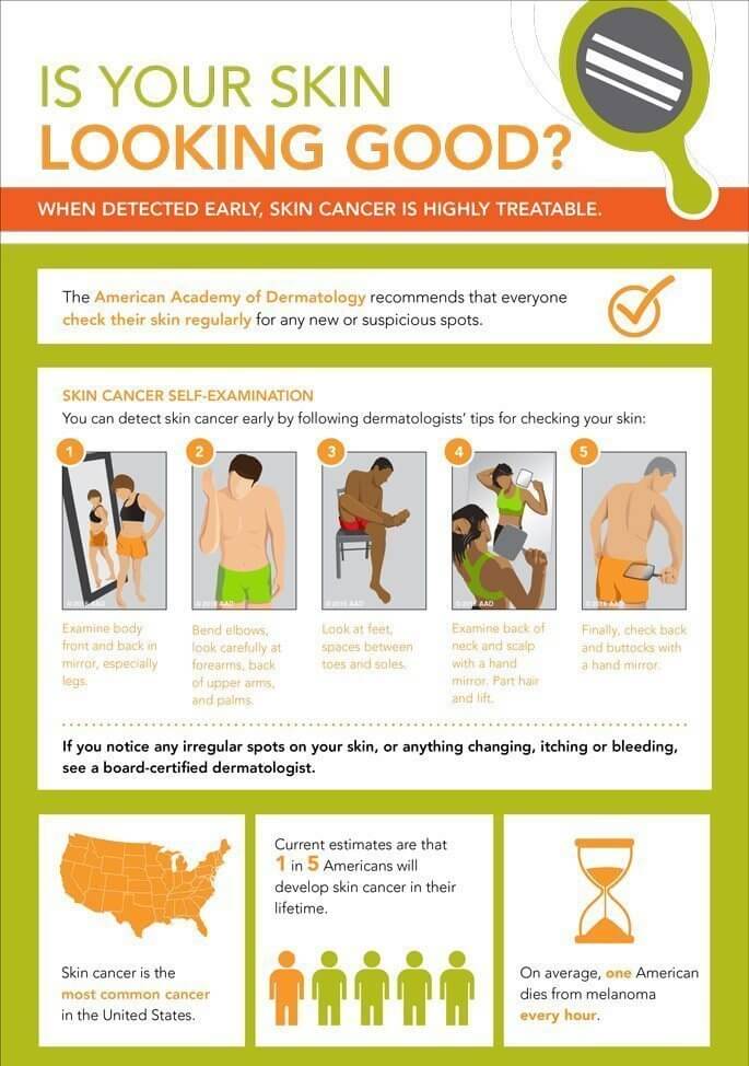 Check Signs of Skin Cancer