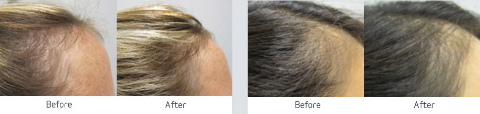 Professional hair care before and after