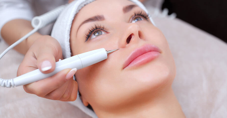 Microneedling Treatment (Collagen Induction) in Coral Springs