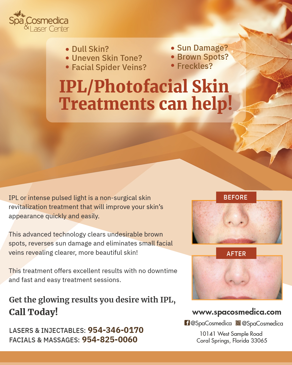 , See the Beautiful Skin Results with IPL!