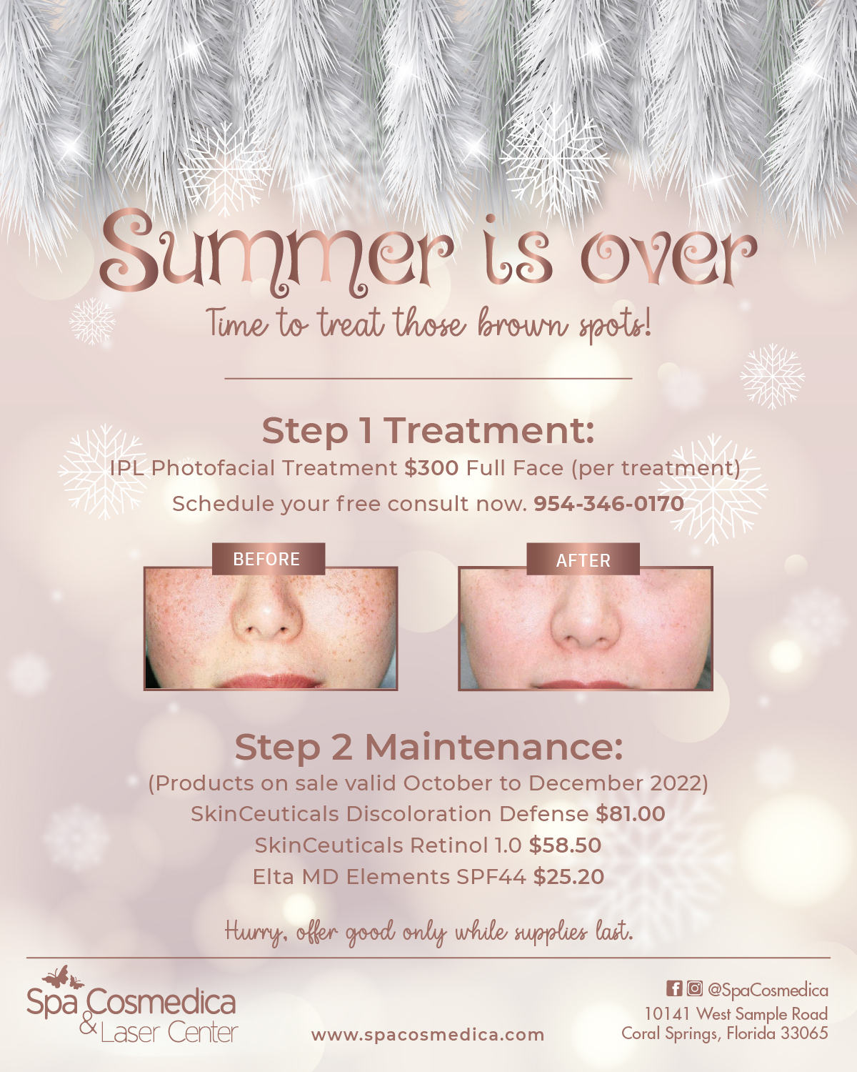 , Summer’s Over Time To Treat Those Brown Spots!